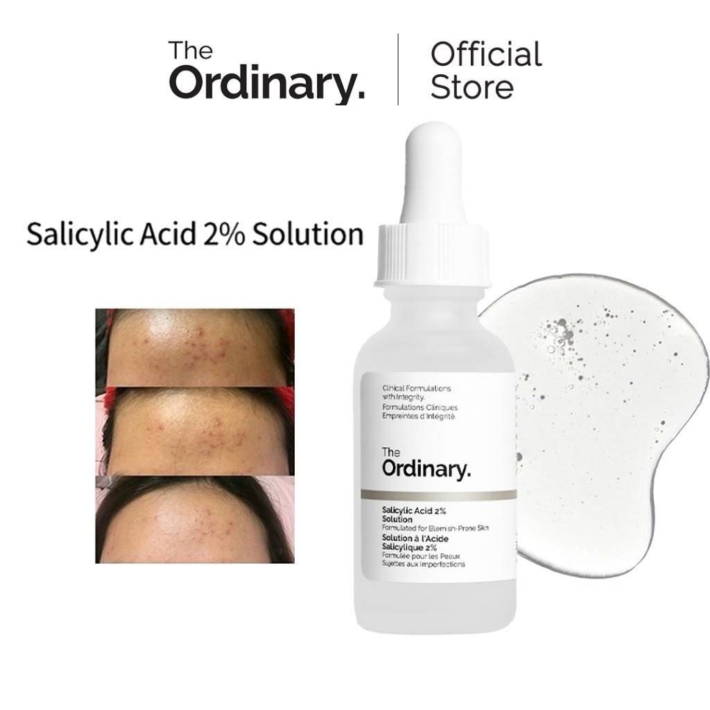 The Ordinary Salicylic Acid 2% Solution for Blemish Prone Skin 30ml product image